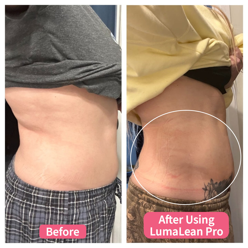 LumaLean Ultra