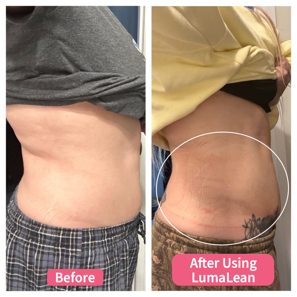 LumaLean Ultra