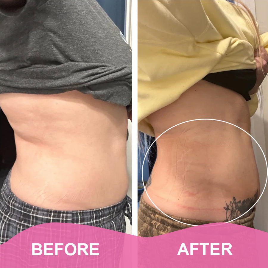 LumaLean Advanced Sculpting